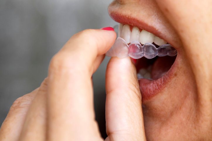 Anthony Brown Dental photo 4