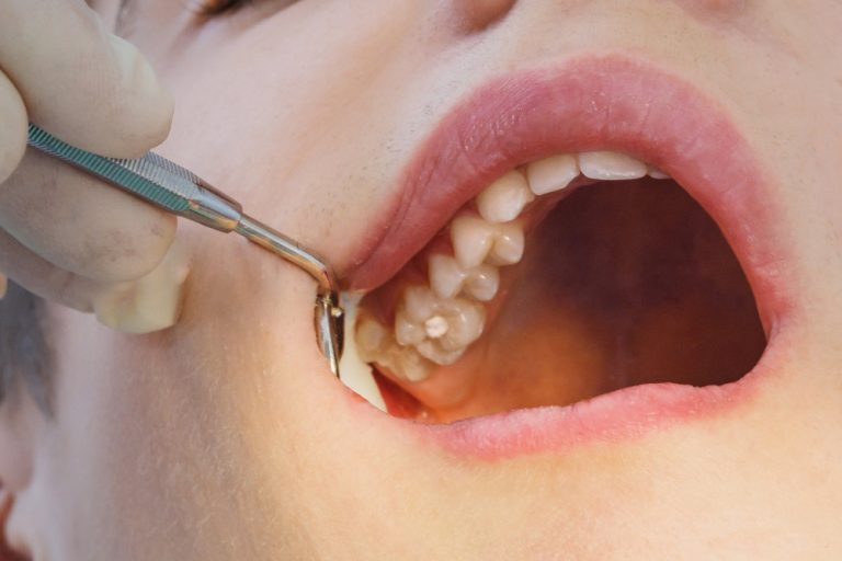 Heatherton Dental photo 4