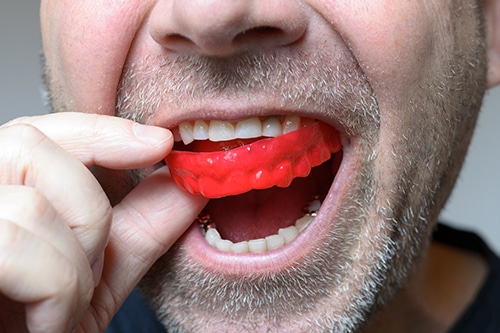 ProCare Dental Australia photo 3
