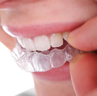 Optimum Dental photo 2