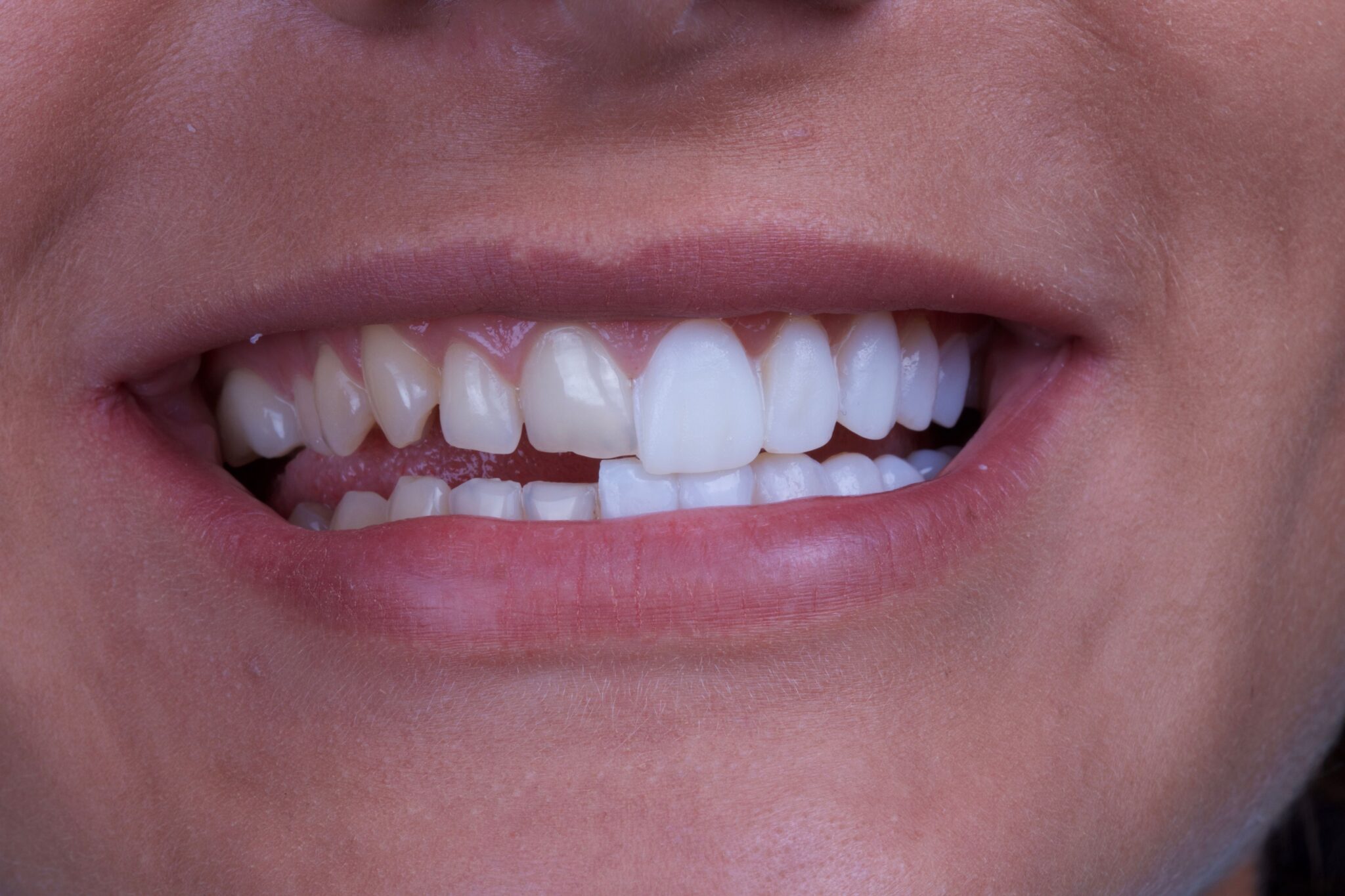 Peninsula Gateway Dental photo 4