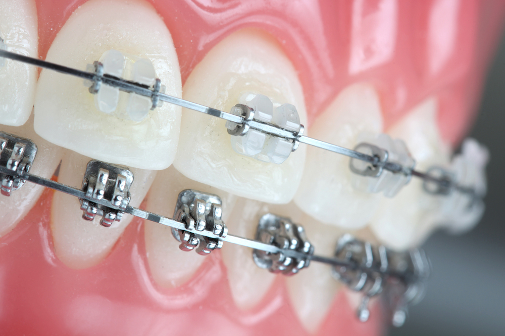 Vanco Orthodontics photo 3
