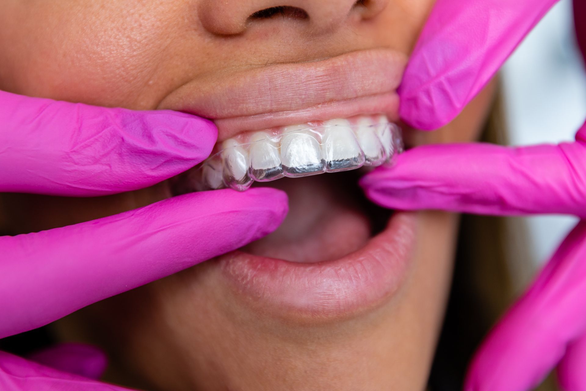 D'Vine Smiles - Dentist Greensborough photo 4