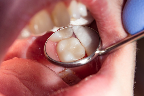 Gymea Dental photo 3