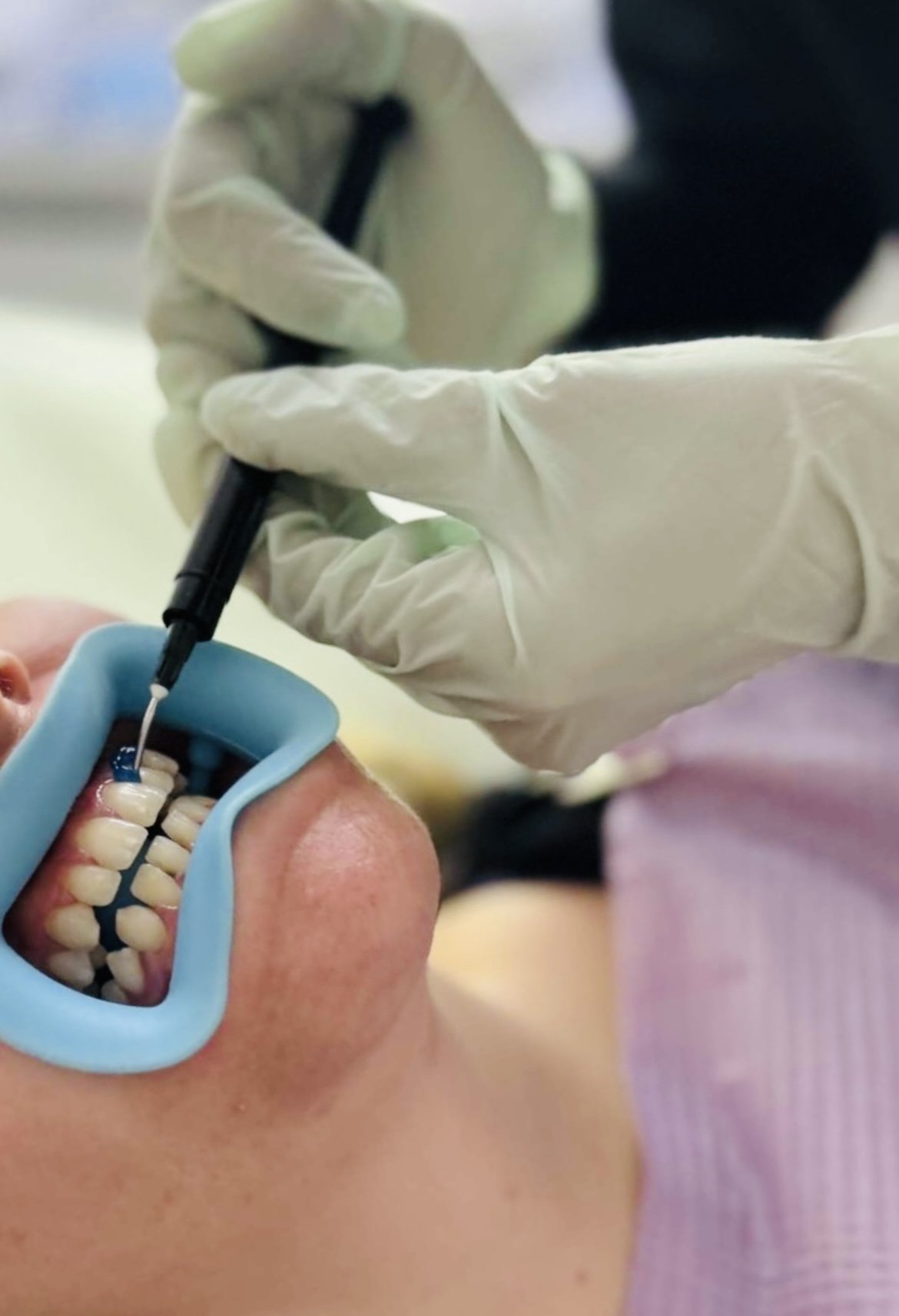 Luminous Teeth Gympie photo 1