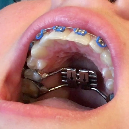 Adelaide Orthodontics photo 3