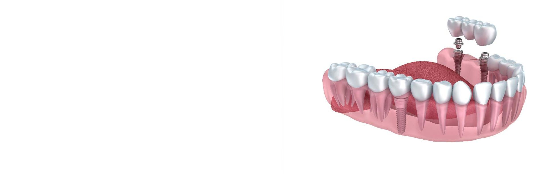 Priority Dental Care photo 4