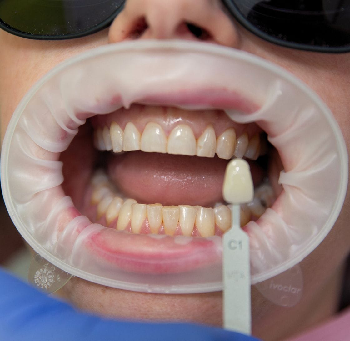 Urban Smile Orthodontics - Hawthorn photo 4