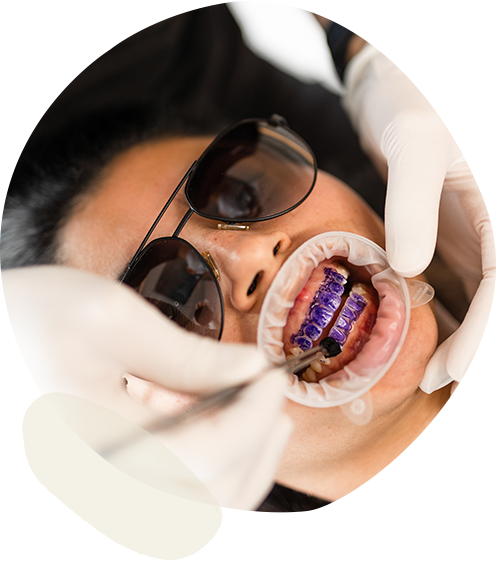 Sleek Teeth Whitening photo 2