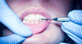 iSmile Dental Centre photo 4