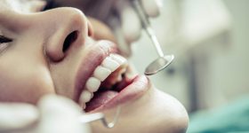 iSmile Dental Centre photo 3