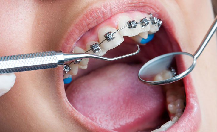 Whitehouse Dental Services photo 4