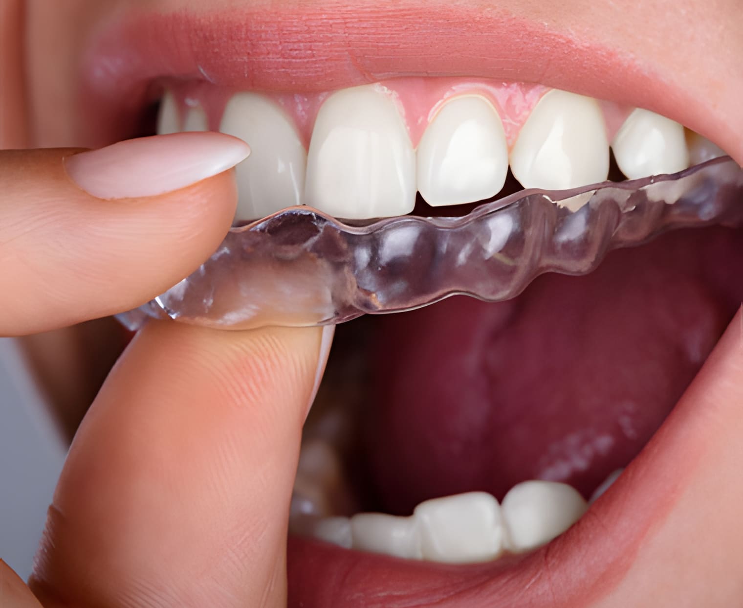 Jordan Springs Dental Care photo 4