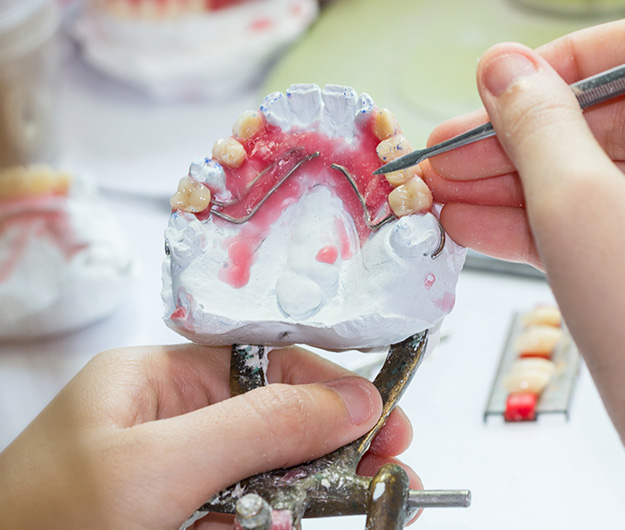 Dental X-Pressions photo 2