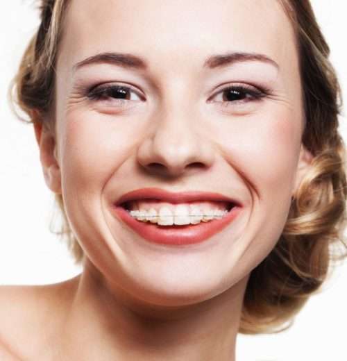 Supreme Dental Lalor photo 3