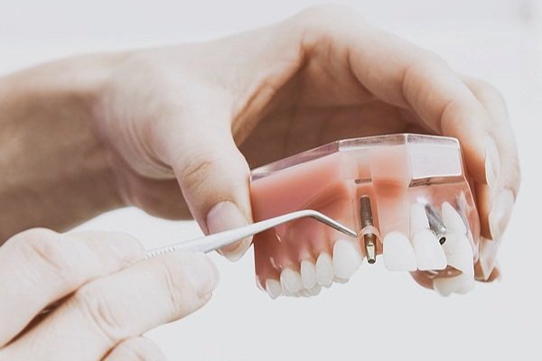 Diamond Dental Centre photo 3