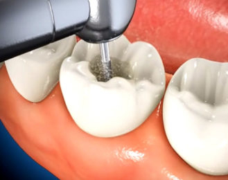 Valley Dental Clinic photo 3