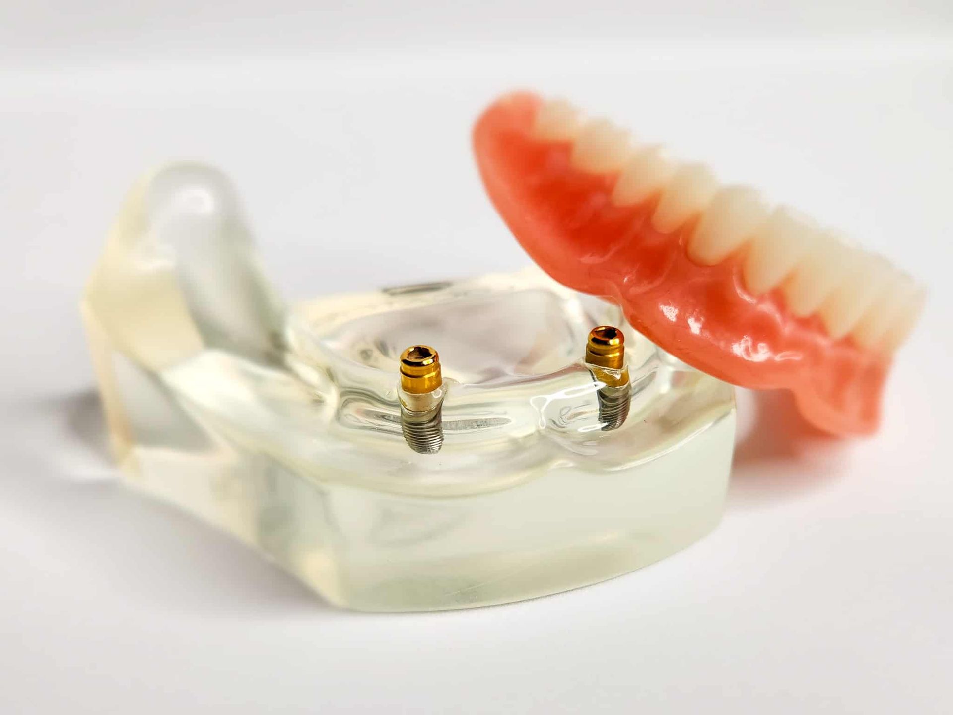 Cosmetic Denture Services photo 1