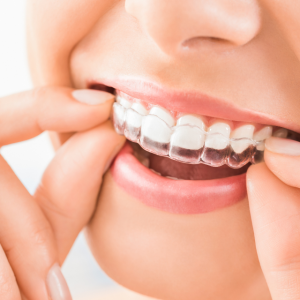 Everwell Dental (Formerly Known as My Affordable Dentists & Denture Clinic) photo 2