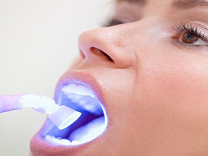 Dental Care On Wondall photo 1
