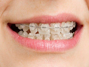 Dental Care On Wondall photo 2