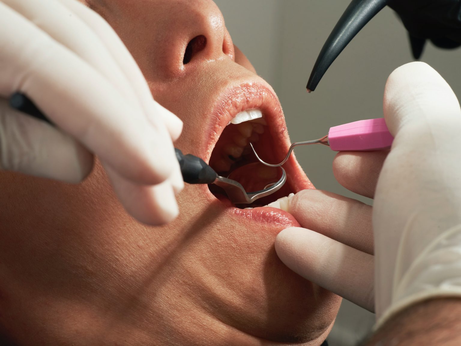 iDental Surgery photo 2