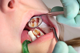 Pemulwuy Dental photo 3