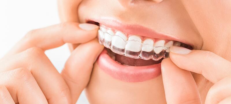Pimpama City Dental Centre photo 4