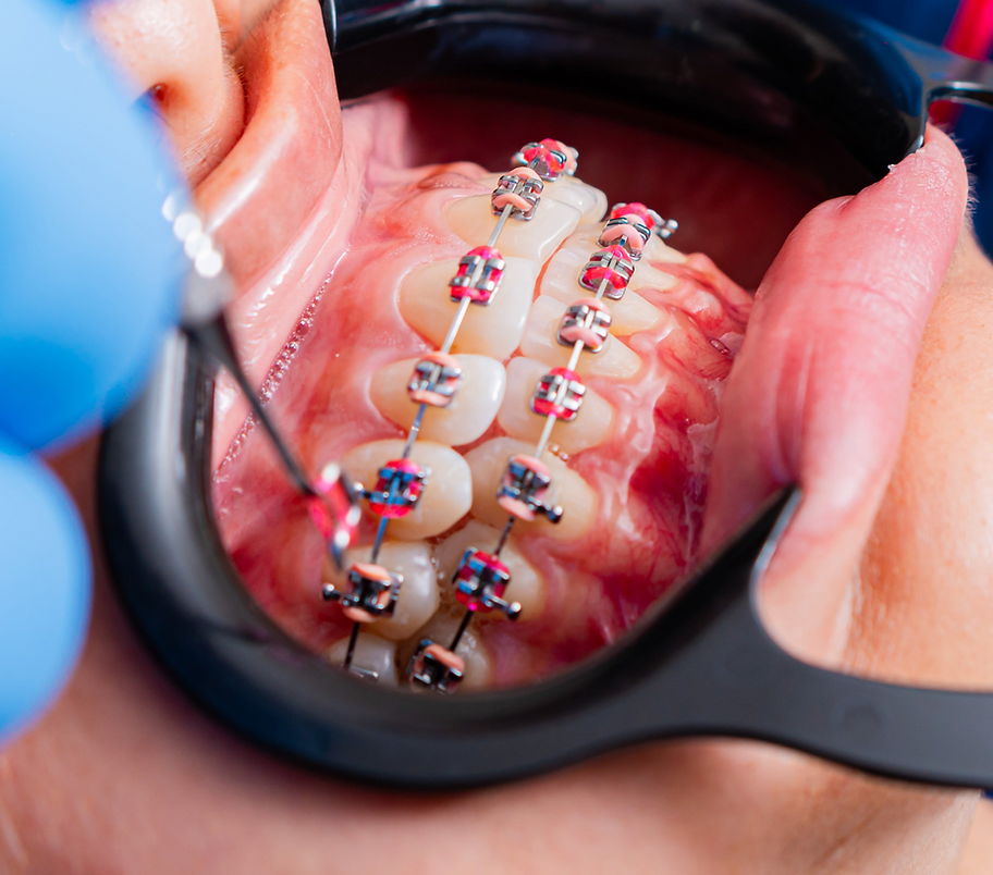 Range Dental - The Oral Experts Group photo 2