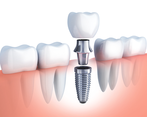 Go Dental Care photo 2