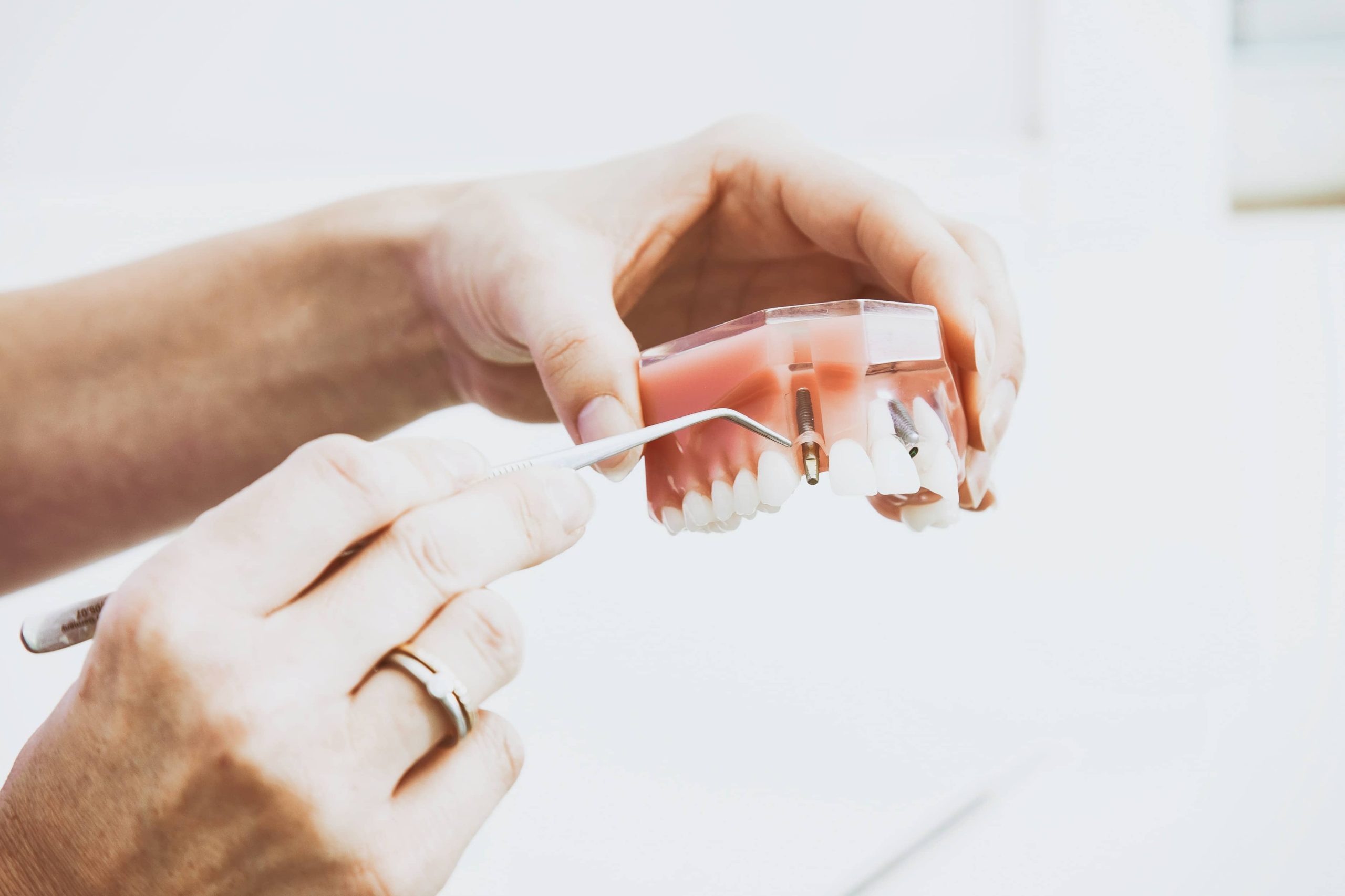 Diamond Dental bundoora photo 4