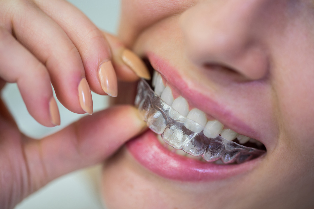 Diamond Dental bundoora photo 2
