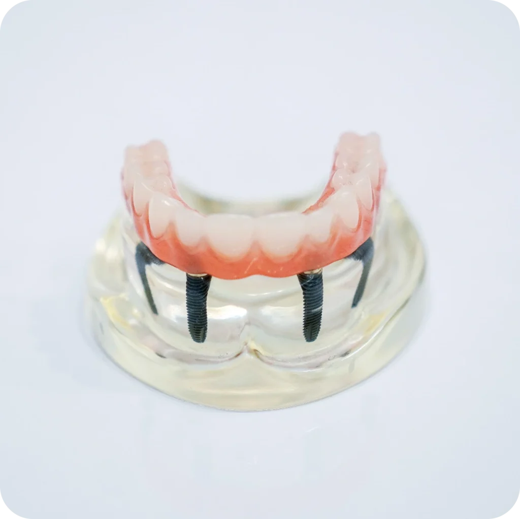 Impressions Dental Studio photo 1