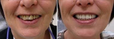 ABA Dental and Denture Clinic photo 4