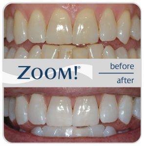 ACACIA RIDGE DENTAL photo 3