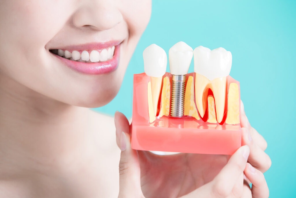 Alfredton Dental Ballarat photo 3