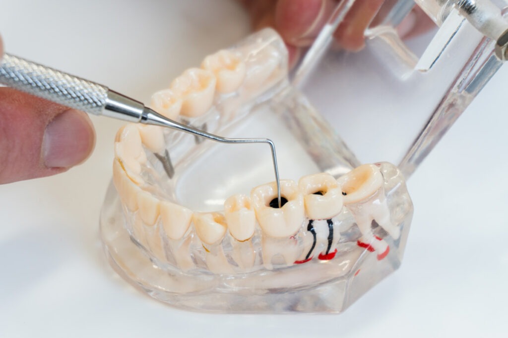 Alfredton Dental Ballarat photo 4