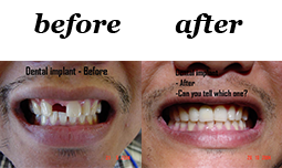 Allambie Dental Centre photo 4