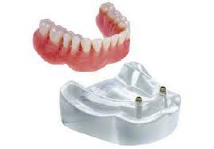 Apple Denture Centre Alfred COVE photo 2