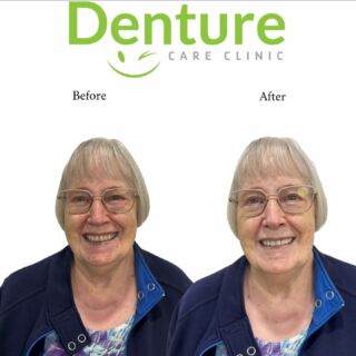 Denture Care Clinic - Altona photo 4
