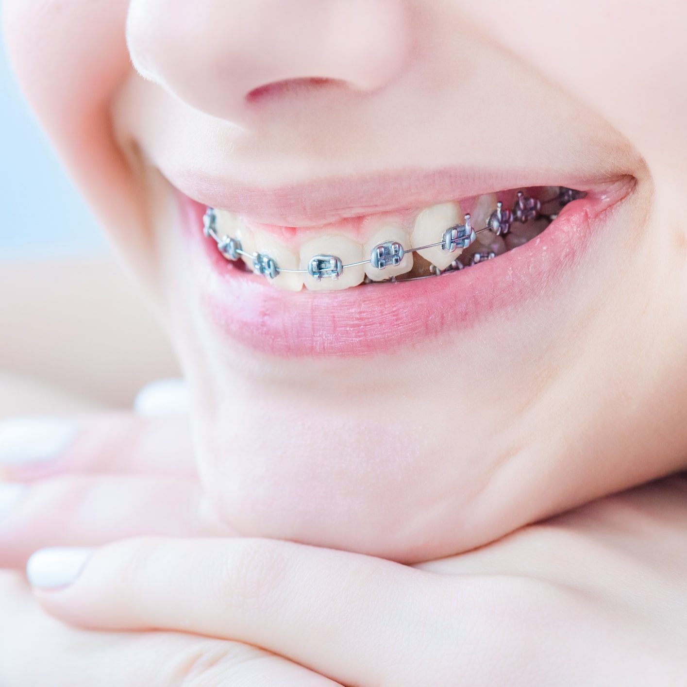Orthodontic Smile Practice photo 1