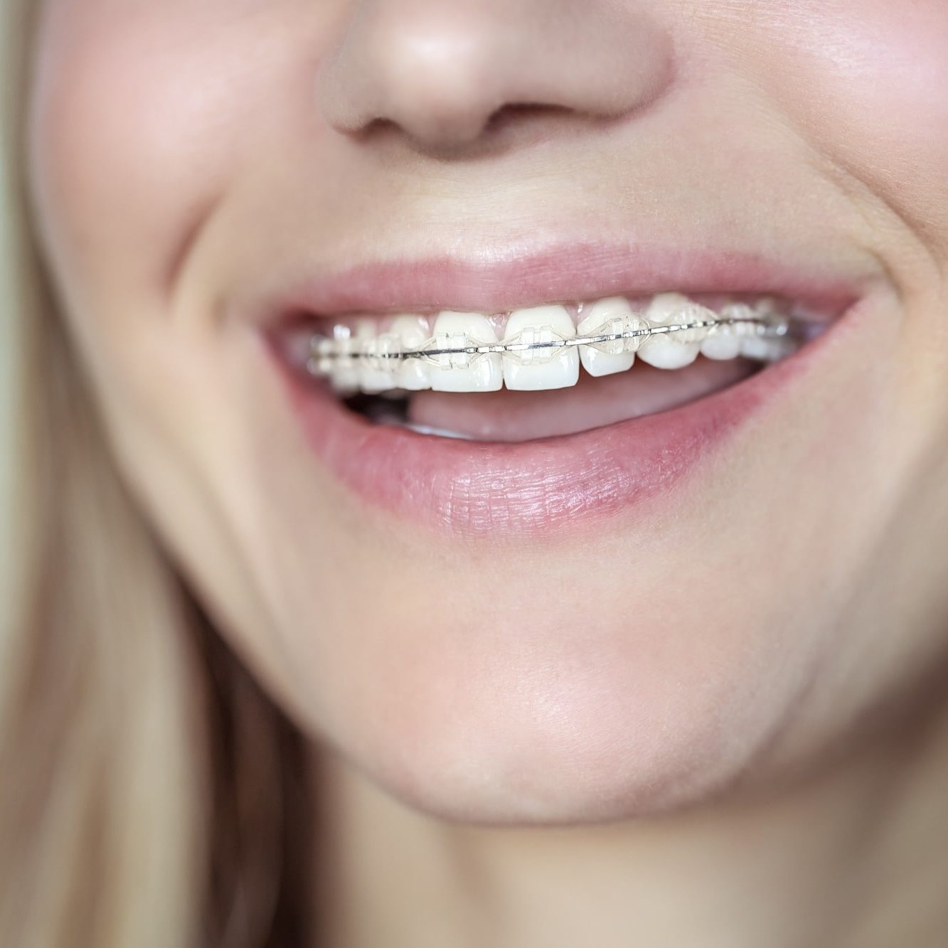 Orthodontic Smile Practice photo 2