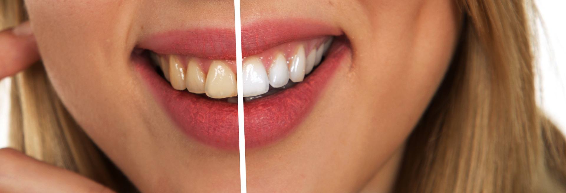 Smile Point Dental Centre photo 1